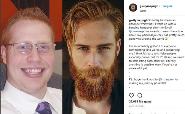 El antes y el después de Gwilyn Pugh. 