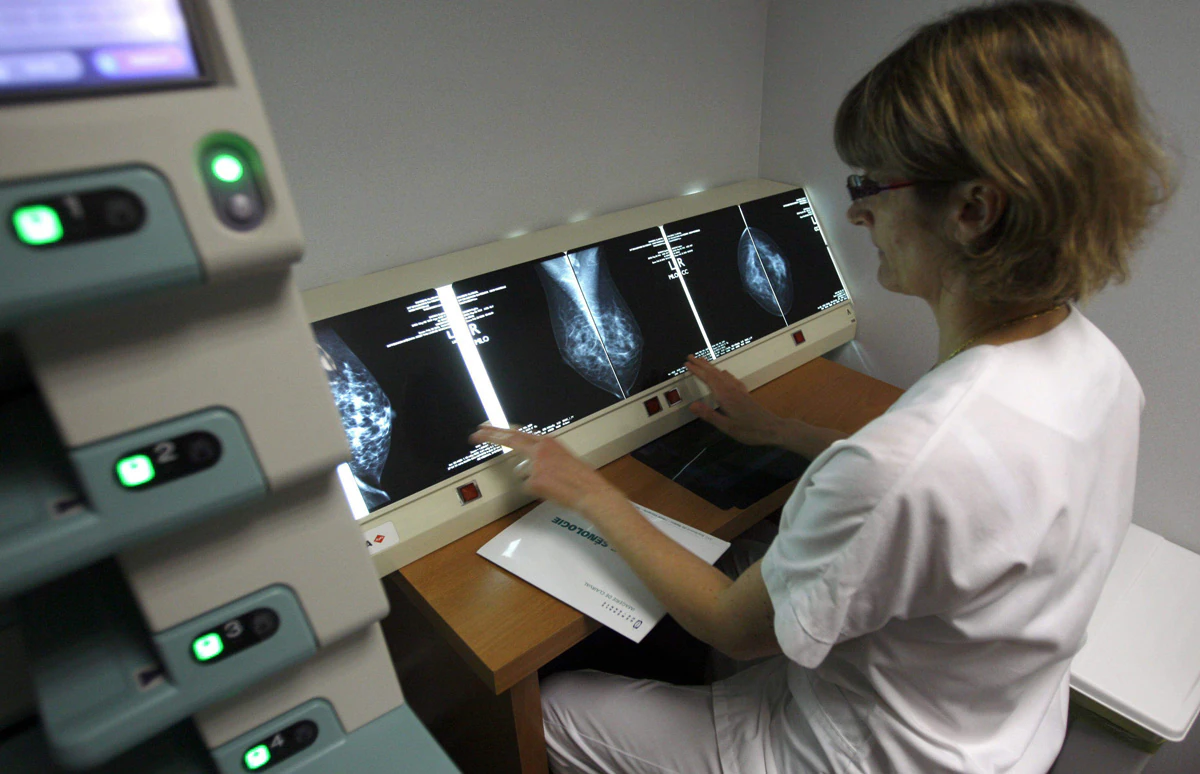 La realización de mamografías es crucial para la detección temprana de la enfermedad (foto de archivo). 