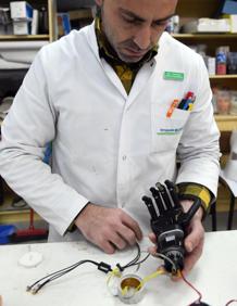 Imagen secundaria 2 - Prótesis inteligentes con firma burgalesa