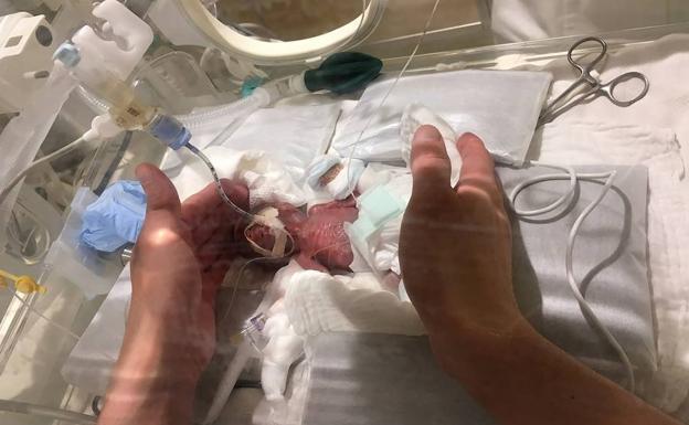 Imagen facilitada por el Hospital Universitario de Keio, en Japón, que muestra al bebé más pequeño del mundo que ha pesado 268 gramos al nacer.