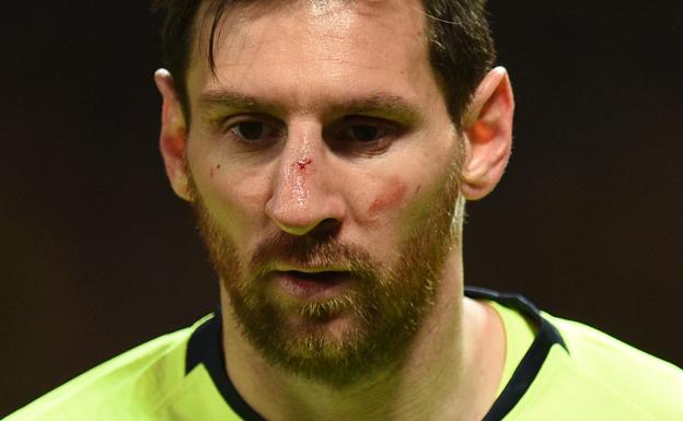 Buenas noticias para Messi: no hay lesión en la nariz ni en el pómulo 