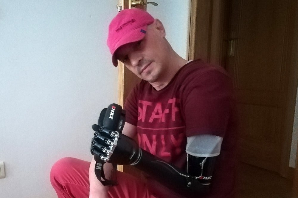 Ramon Fernández ha conseguido manejarse con su prótesis biónica con gran facilidad