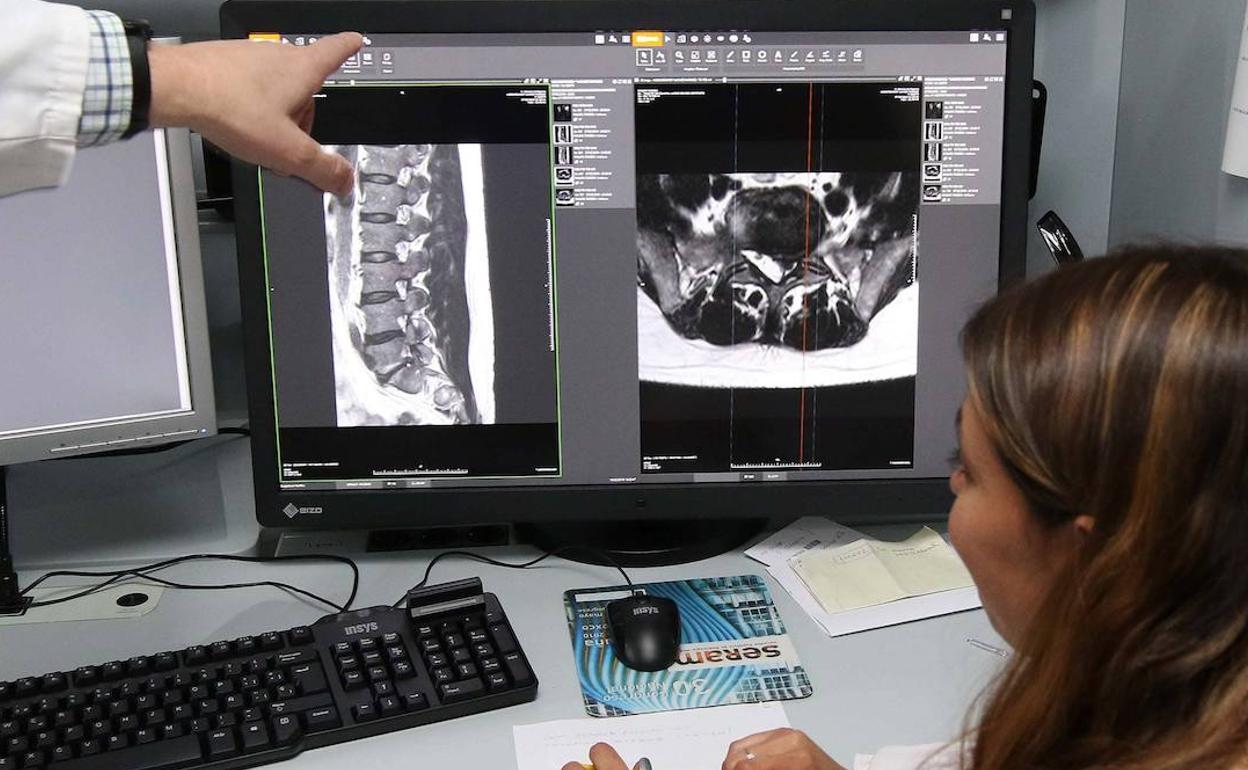 Equipo de radiología en el Hospital de Segovia