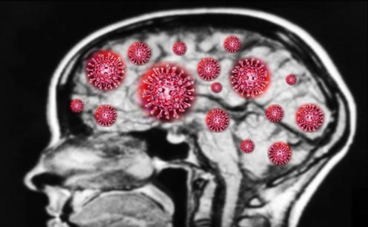Daños neurológicos de la Covid-19