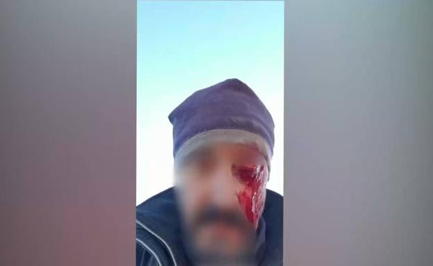 El hombre herido tras la agresión. 