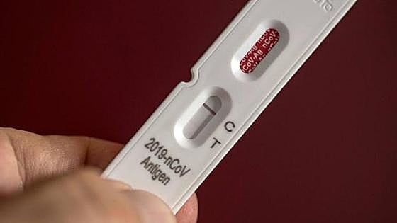 La venta online de test covid disparó las consultas en la OMIC