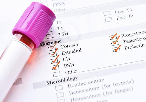 Imagen de un análisis hormonal médico