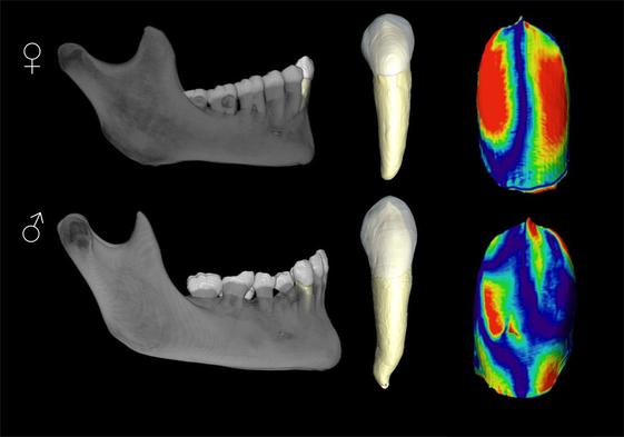 Principales diferencias en la morfología de la dentina de los caninos permanentes de los hombres y las mujeres de las poblaciones actuales.