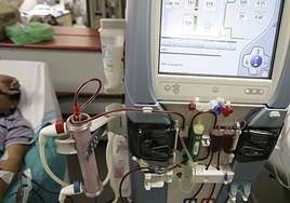 El tratamiento de hemodiálisis de este contrato se presta fuera del hospital.