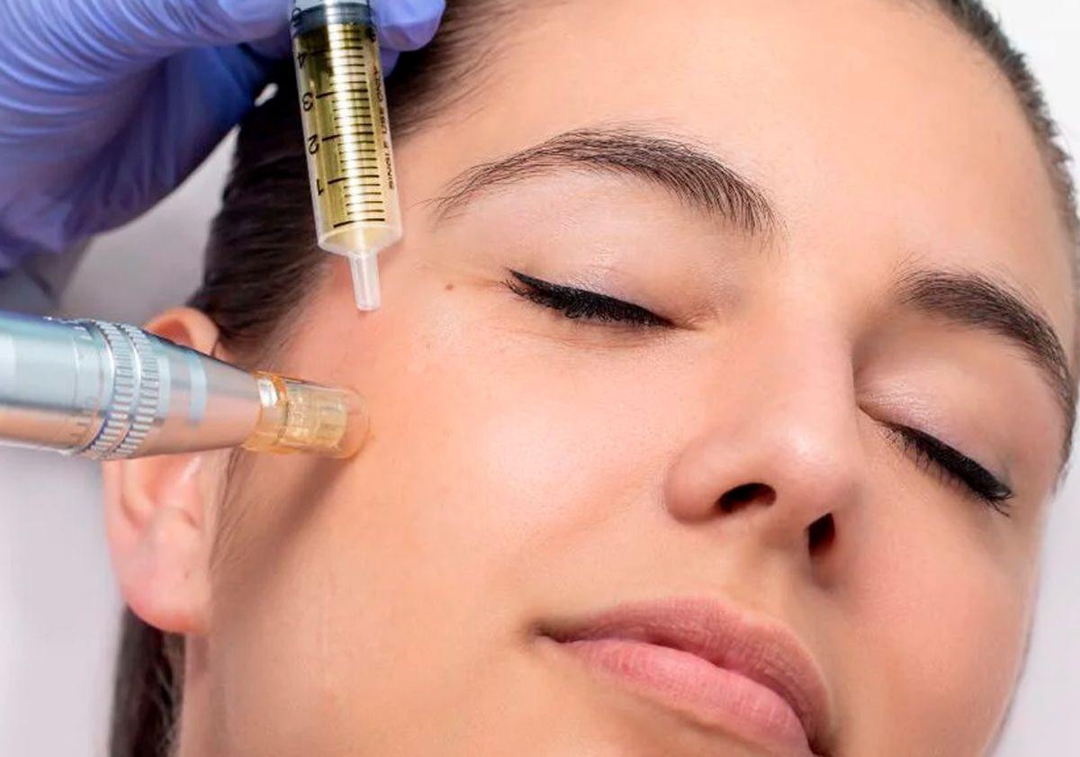 Imagen principal - Exosomas: un gran avance en la estética regenerativa