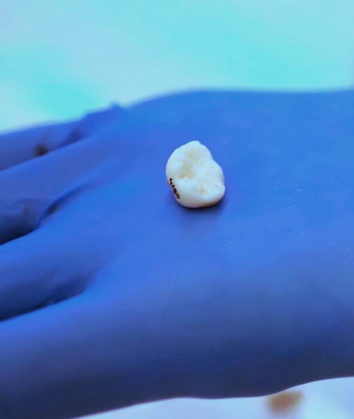 Imagen secundaria 2 - Piezas dentales de la colección Ratón Pérez del CENIEH. 