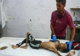 Abdul Jawad al-Ghalban, de 14 años, fallecido por desnutrición, en la morgue del hospital de Khan Jounis, la imagen del horror que sufre Gaza.