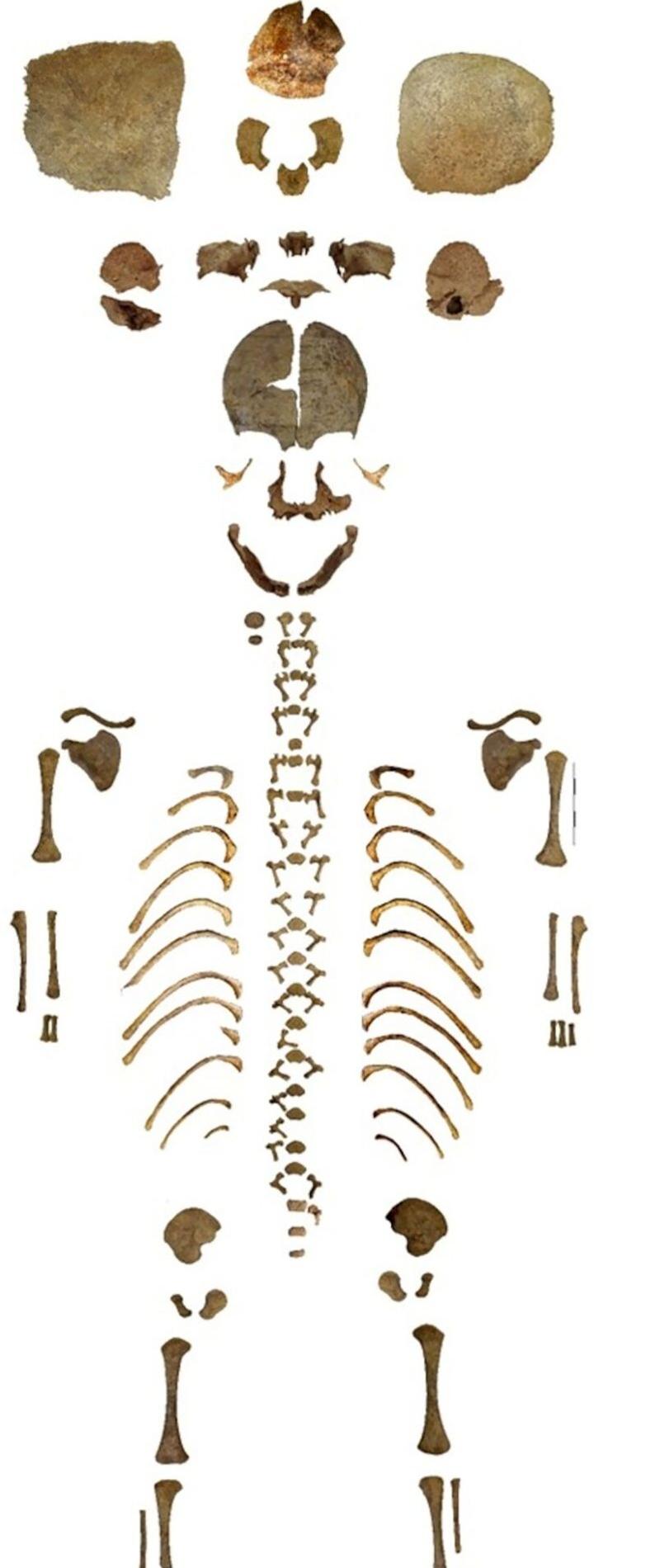 Restos del esqueleto del individuo recien nacido objeto del estudio.