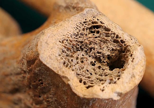 Muestra de un fémur.