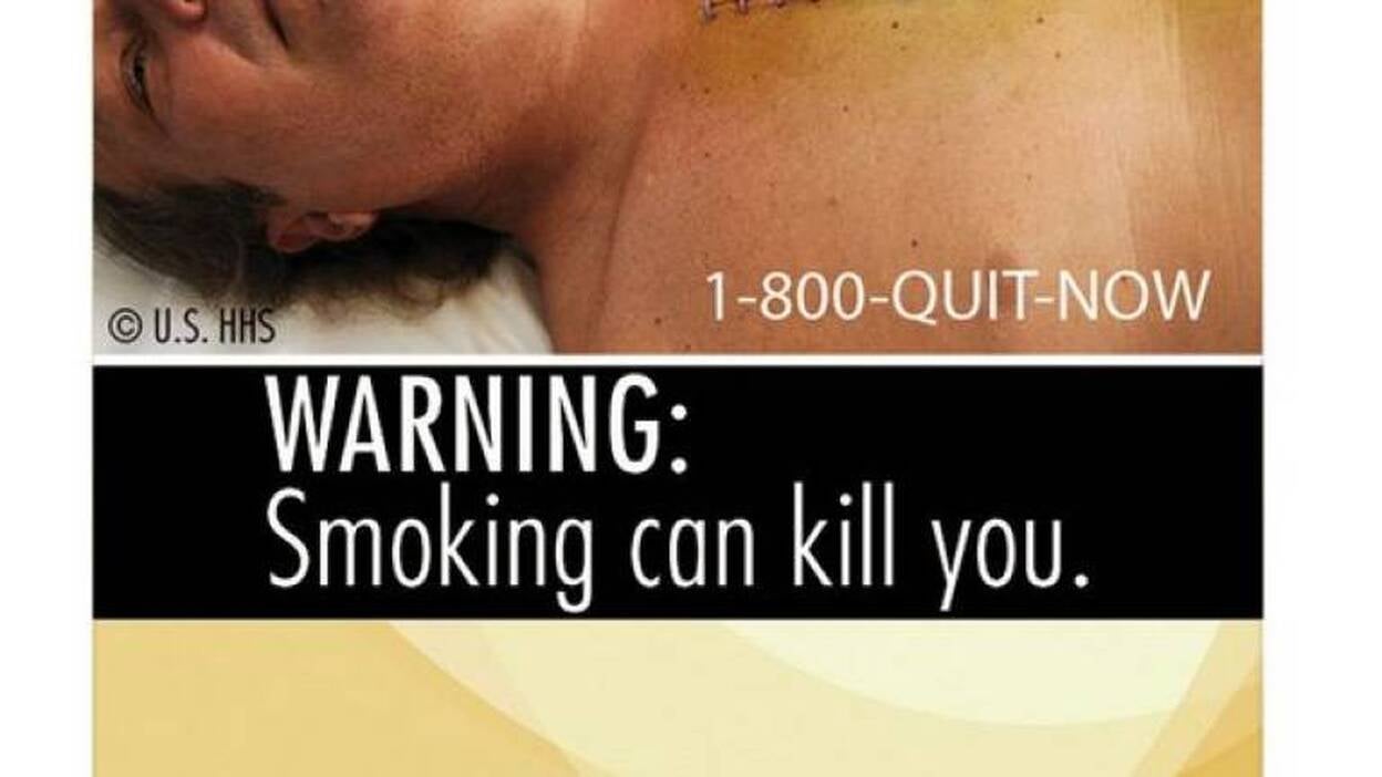 El tabaco perjudica seriamente la salud