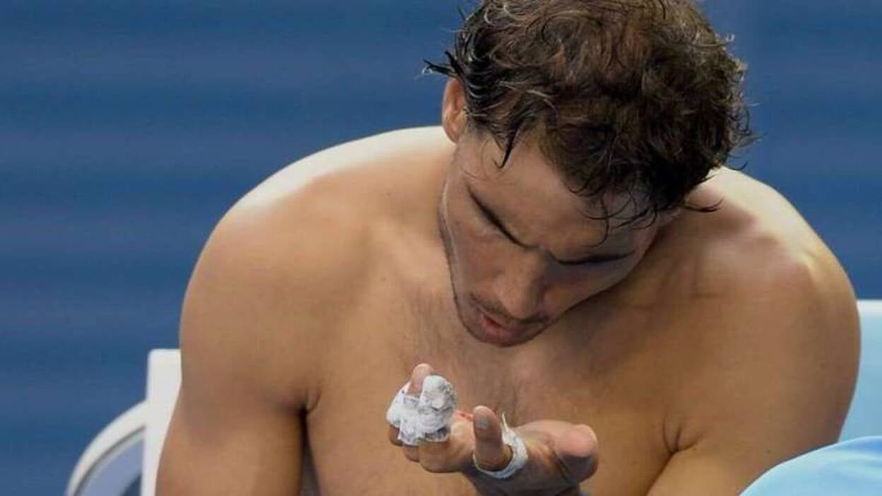 La mano de Nadal, en carne viva