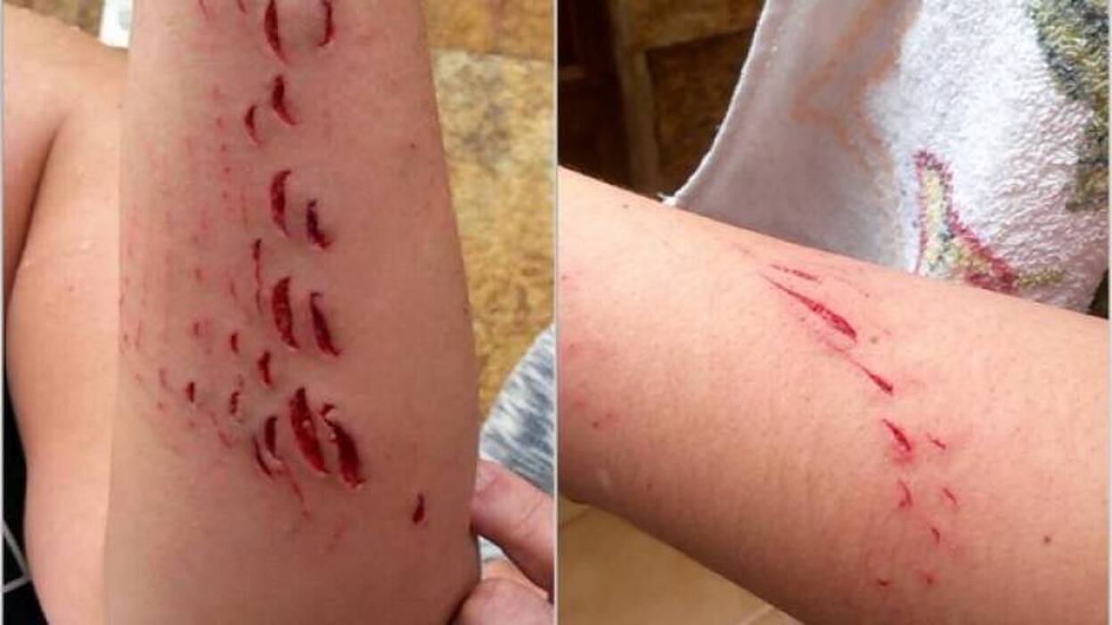 Una mujer es atacada por un tiburón en Arinaga