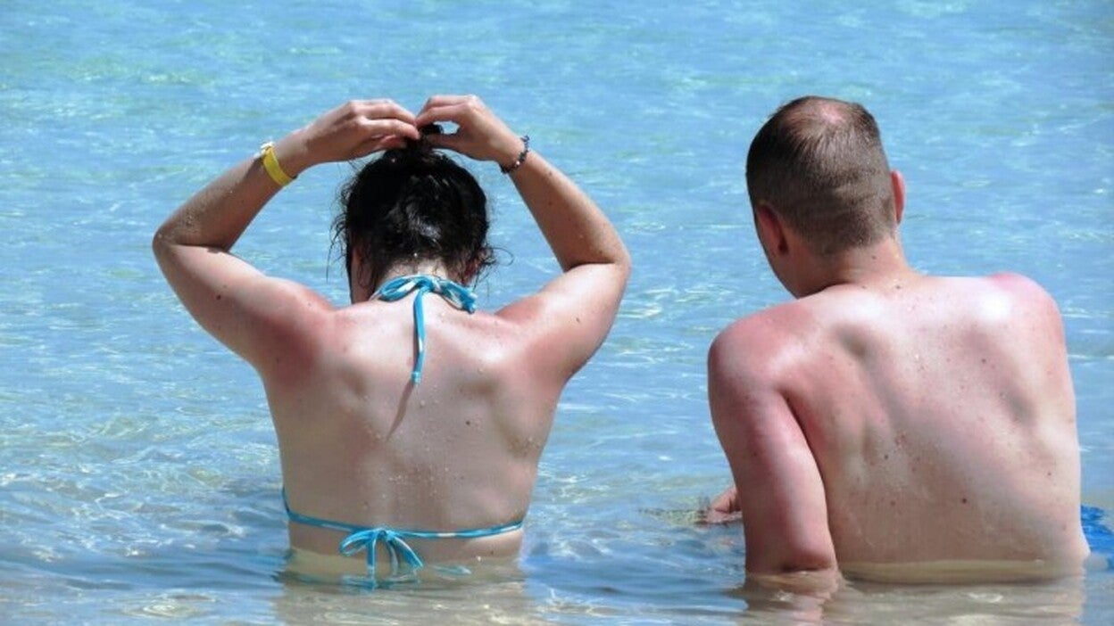 El 90% de los casos de cáncer de piel son carcinomas