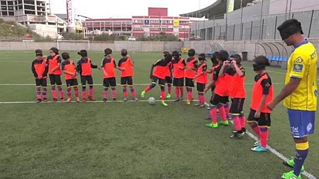 Más de 250 canarios, con problemas de retina