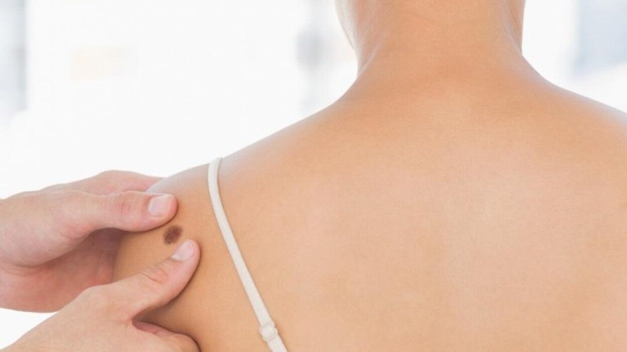 Los problemas dermatológicos suponen un 20% de las consultas pediátricas