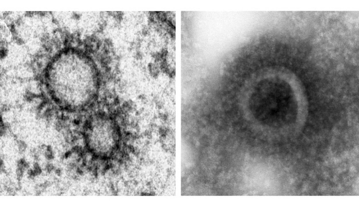 El virus de la gripe construye su propio orgánulo para transportar las moléculas