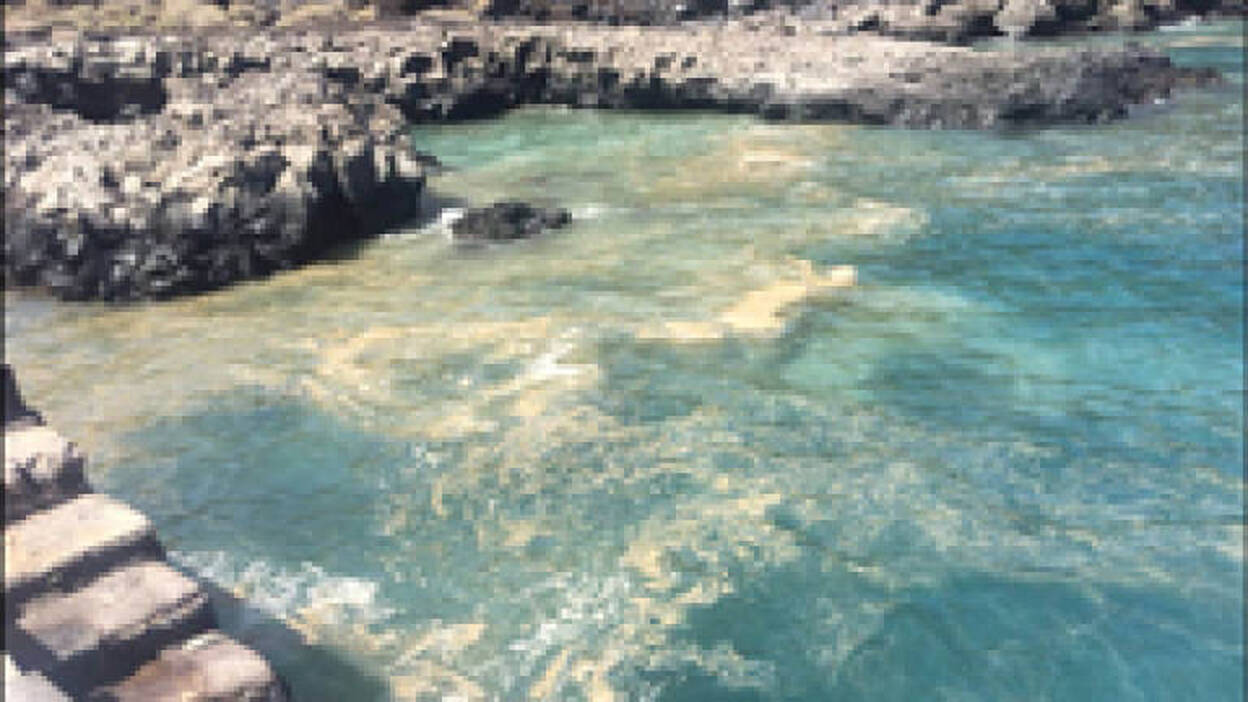 Medidas de protección ante las microalgas