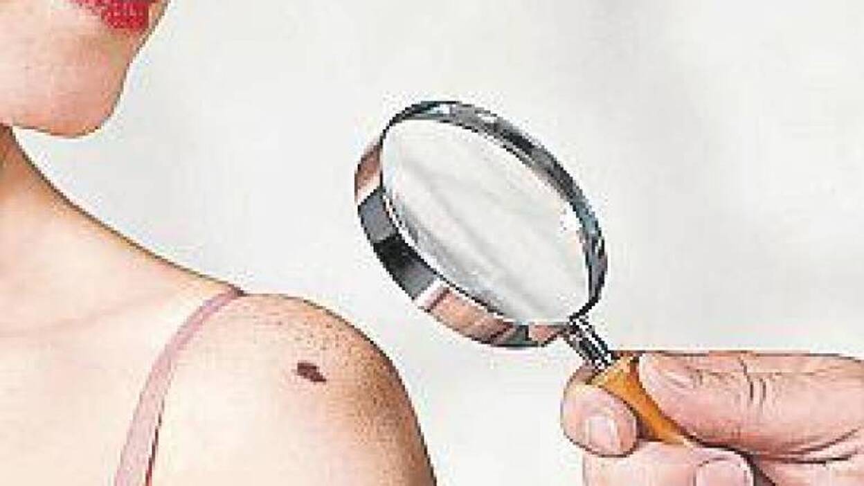 Cáncer, la supervivencia en 2030 solo será posible con una estrategia nacional