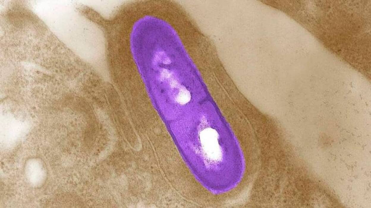 La listeria, el nuevo peligro de la cocina, mata a 70 personas al año en España