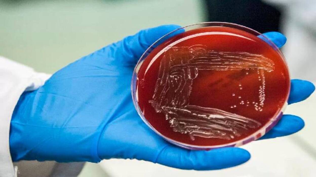 España registra unas 25 muertes al año por listeria