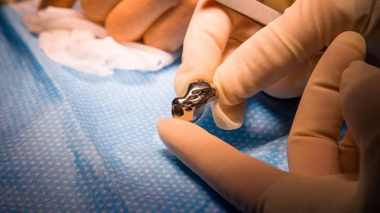 Primer implante de escafoide en 3D en una mano lastrada