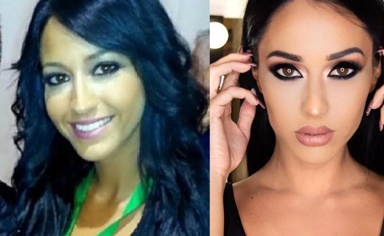 Aurah Ruiz, antes y después de sus operaciones estéticas