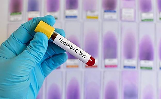 El 95% de los pacientes sometidos a los nuevos antivirales de acción directa supera la hepatitis C