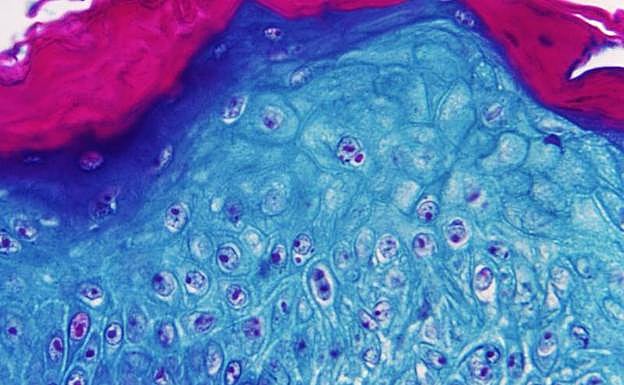 Imagen ampliada con un microscopio de una muestra de piel de un mono infectado con el virus de la viruela del mono. 