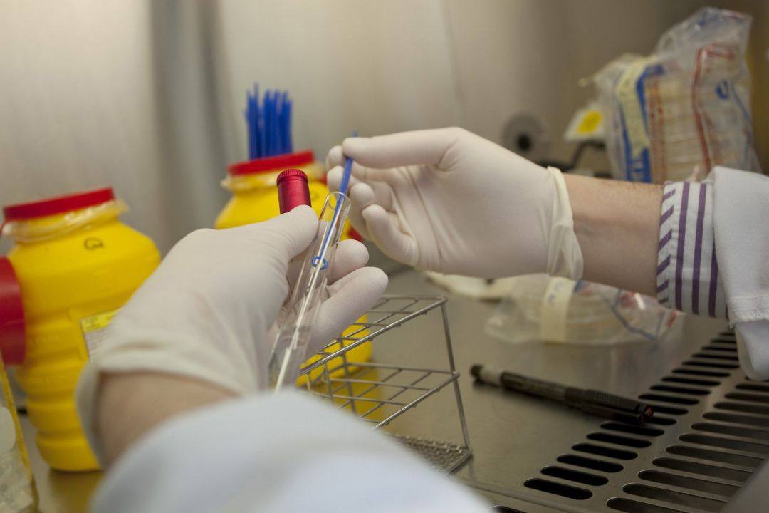 Dos nuevos casos confirmados en Canarias de viruela del mono