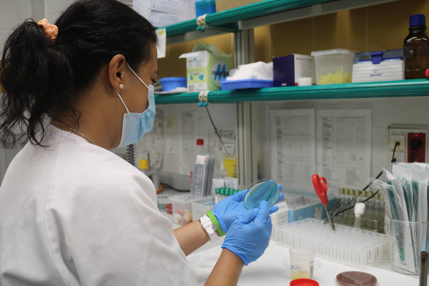 Sanidad registra cuatro casos confirmados y uno en estudio de viruela del mono desde ayer