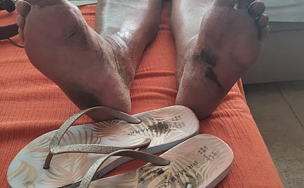Así se le quedaron hoy mismo, martes, los pies y las cholas a una bañista de la playa de Morro Jable. 