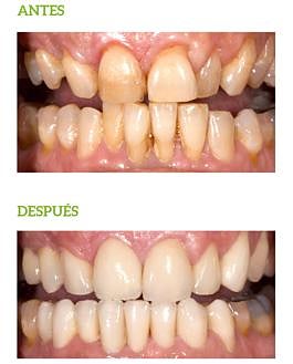 Imagen secundaria 2 - 1.-Dr. Conde en consulta. 2.-Dr. Poggio en quirófano. 3.- Periodoncia corona. 