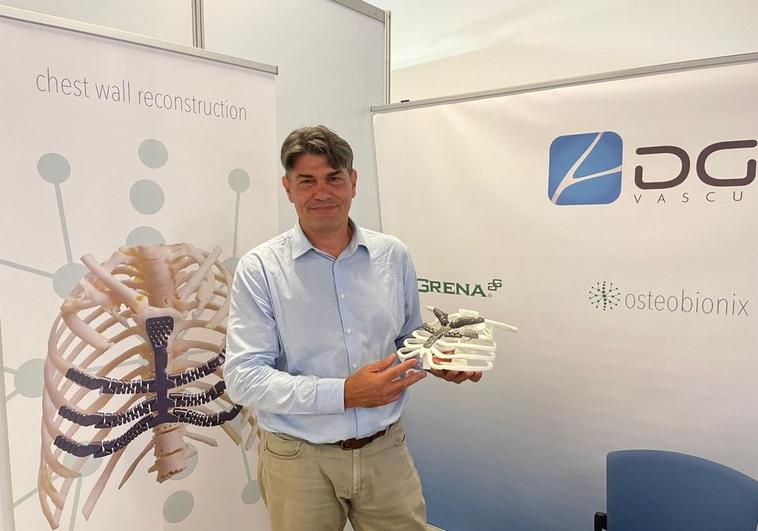 Canarias, referente mundial en el diseño e implantación de prótesis torácicas en 3D