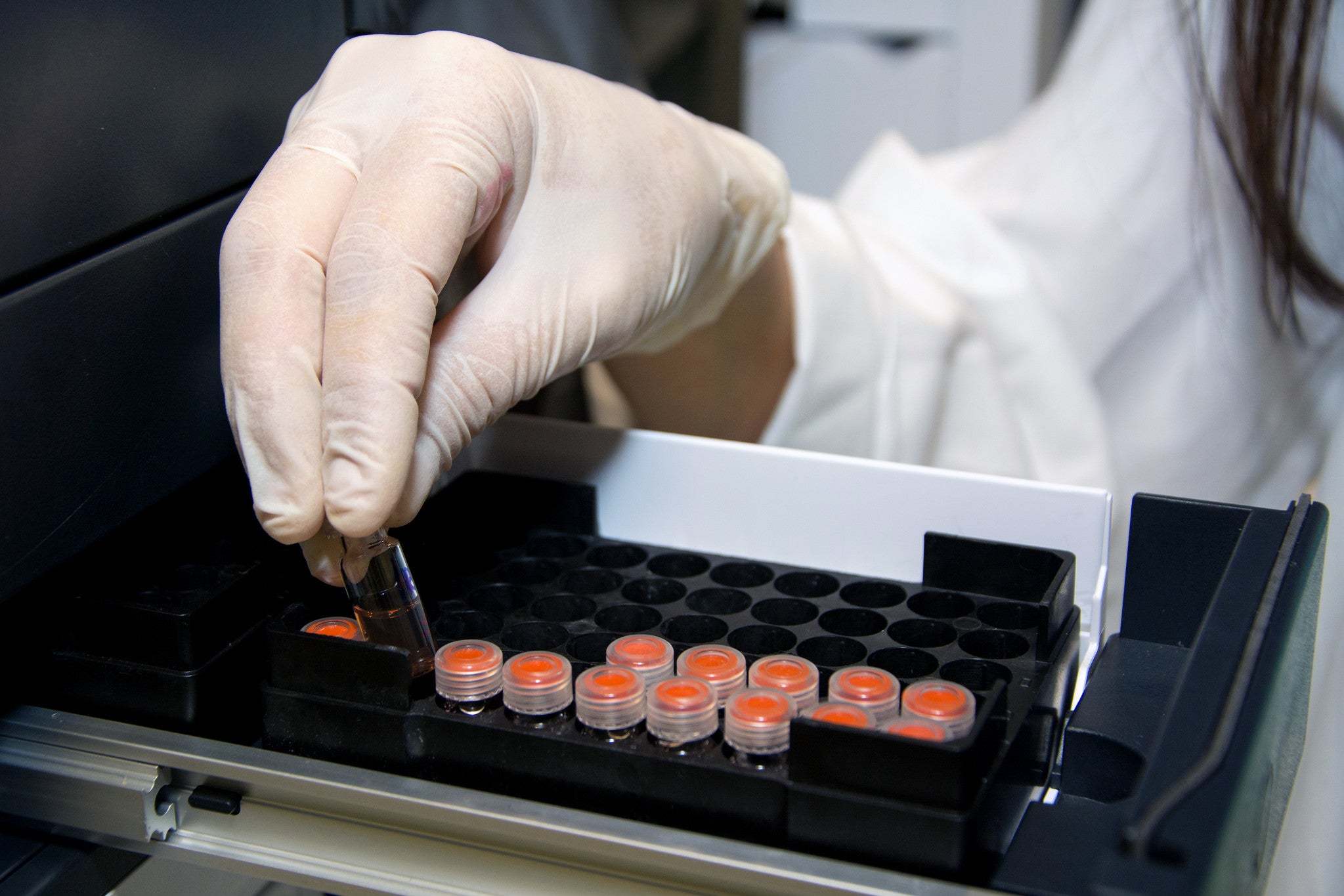 La población canaria está expuesta a más de 110 contaminantes químicos