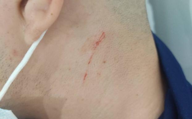 Denuncian una presunta agresión de la Policía Local a un menor en Santa Lucía