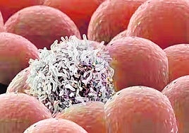 Una célula cancerosa entre células sanas.