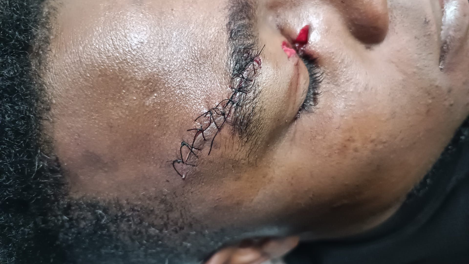 Imagen principal - La Policía detiene al presunto autor de un apuñalamiento en la pasada madrugada