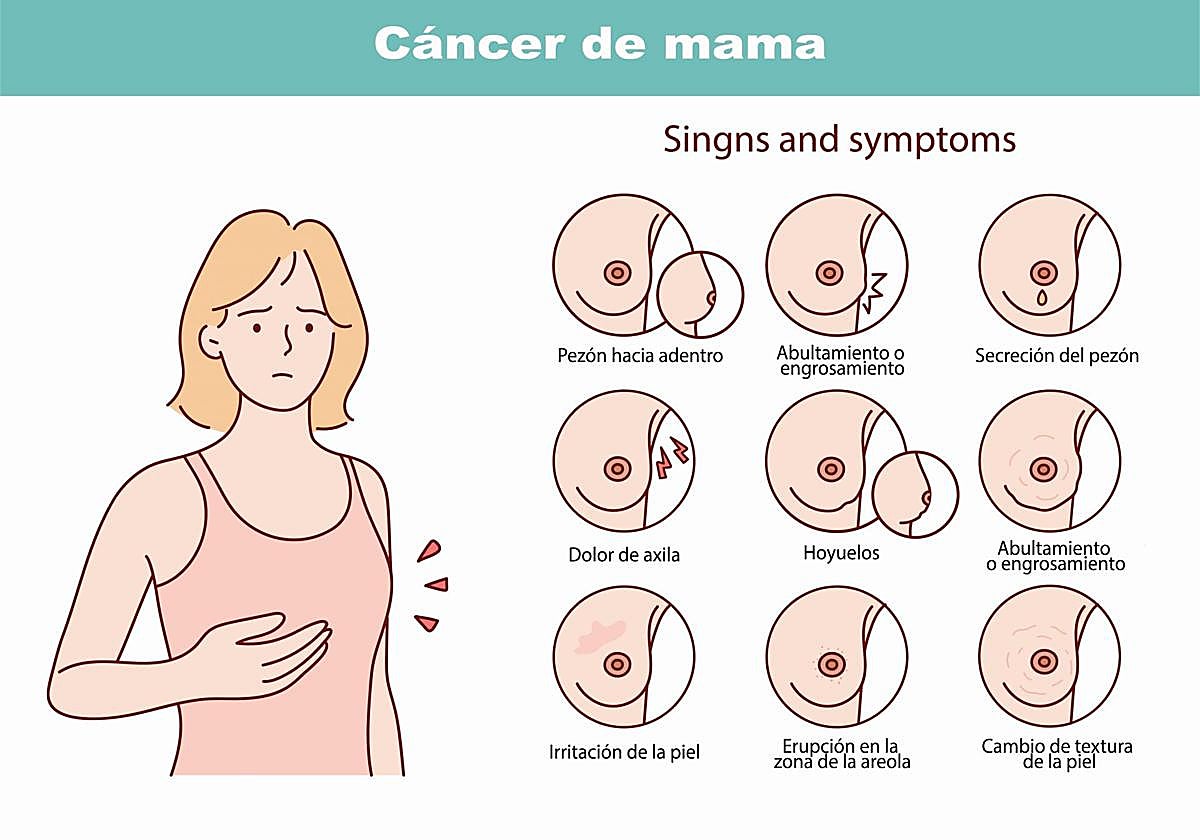 Concepto de cáncer de mama y sus síntomas.