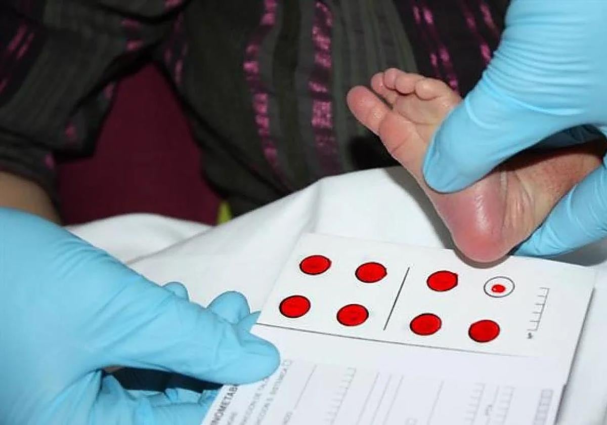 Imagen de la realización de una prueba en el talón de un bebé.