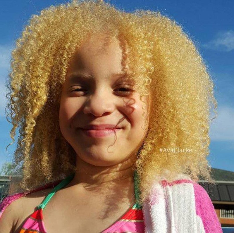 Ava Clarke, la niña negra albina que enamora en la red