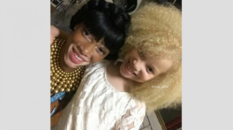 Ava Clarke, la niña negra albina que enamora en la red