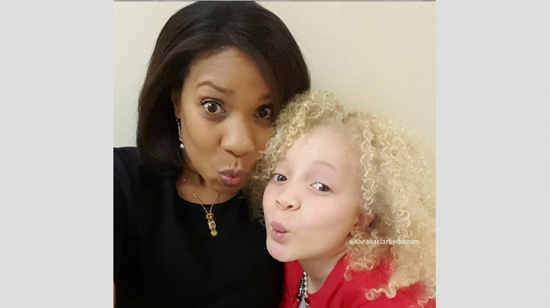 Ava Clarke, la niña negra albina que enamora en la red