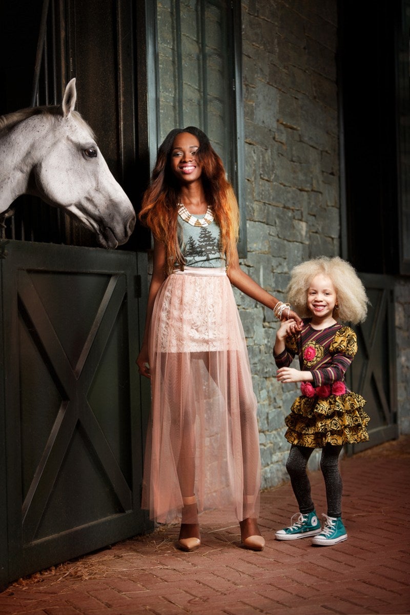 Ava Clarke, la niña negra albina que enamora en la red