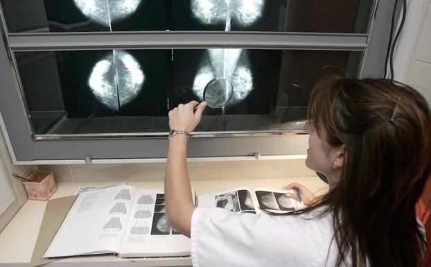La detección precoz del tumor de mama es fundamental para lograr la curación. 