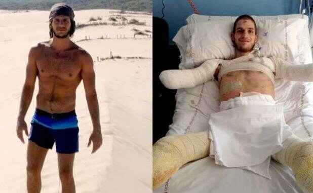 Davide Morana, antes y después de la enfermedad.